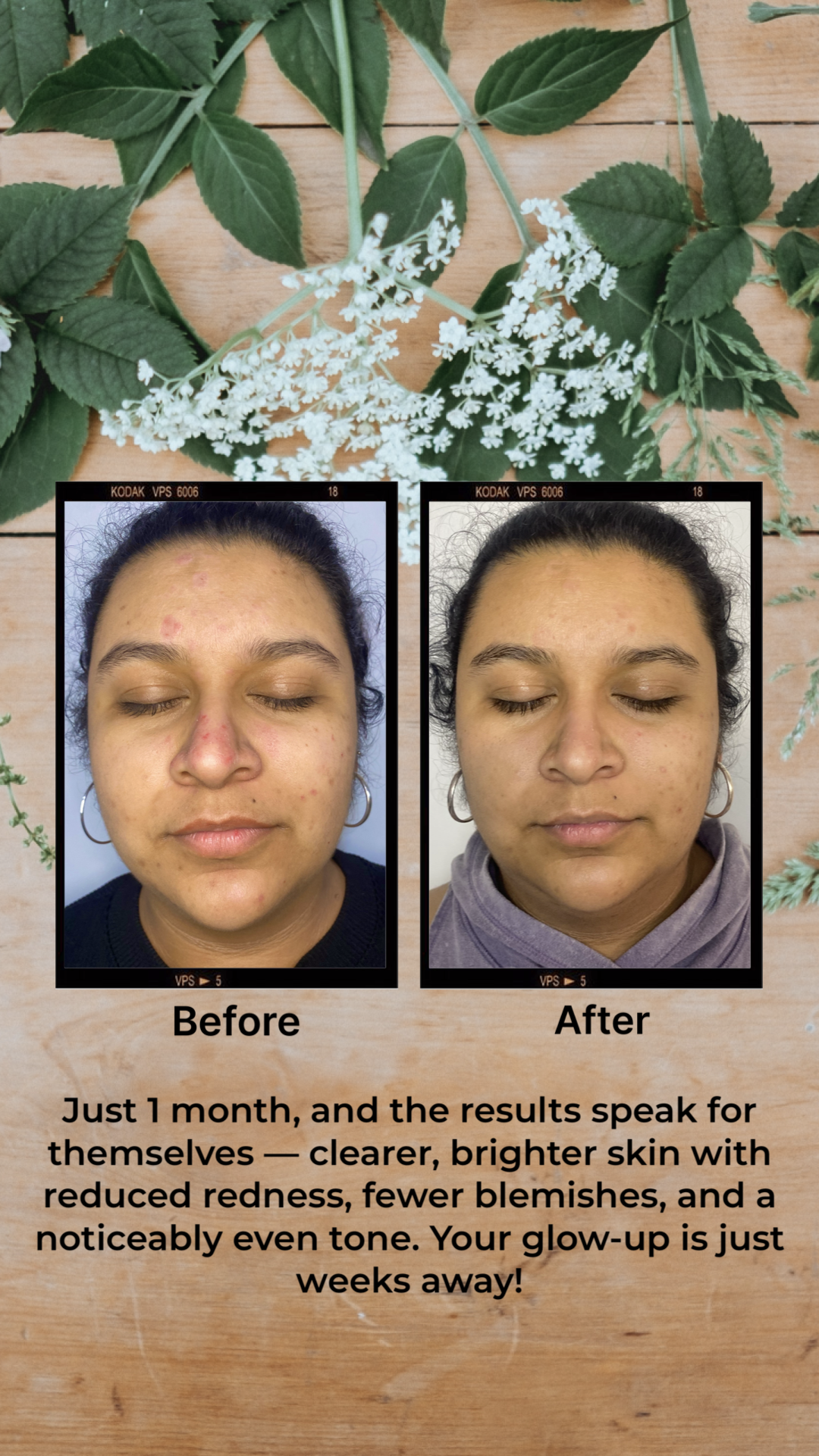 Turmeric & Honey Glow-Up Set